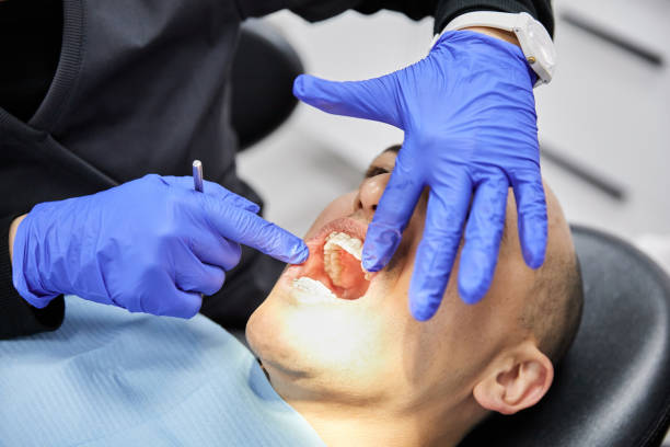 Best Emergency Dental Services for Seniors in Pickens, SC